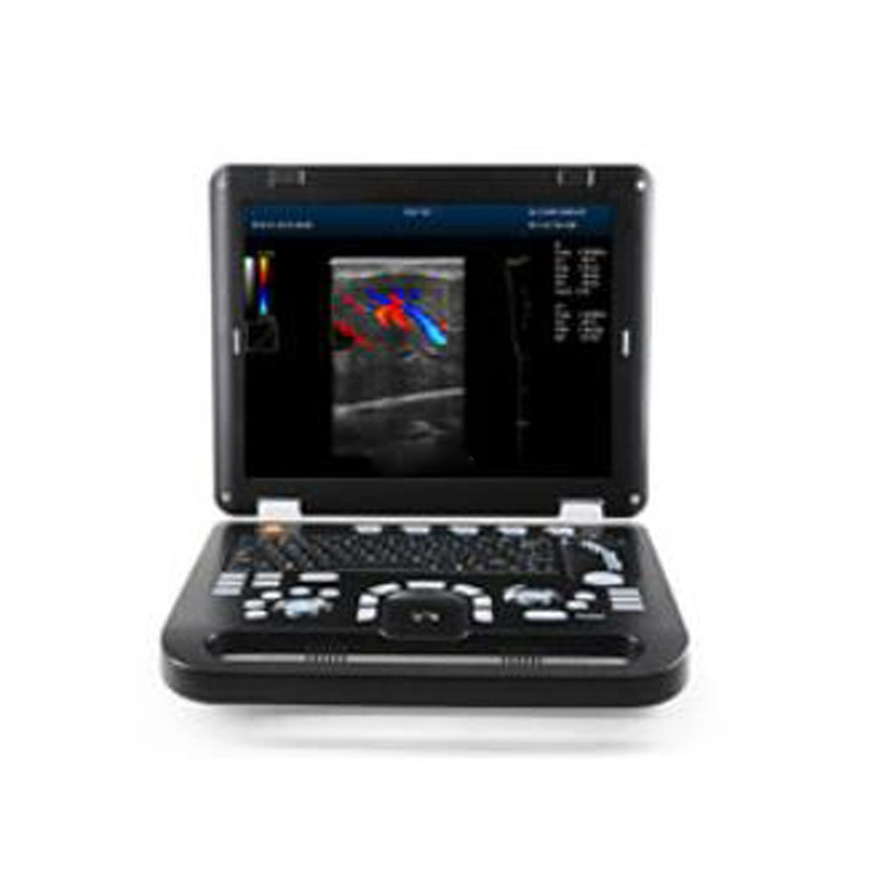 Full Digital Mechanical Sector Ultrasonic Diagnostic Instrument Veterinary Doctor Color 4 D Ultrasound Portable for Vet