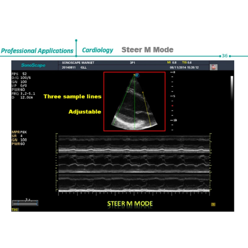 Professional Sonoscape S22 Color Doppler 4D Ultrasound Scanner System China