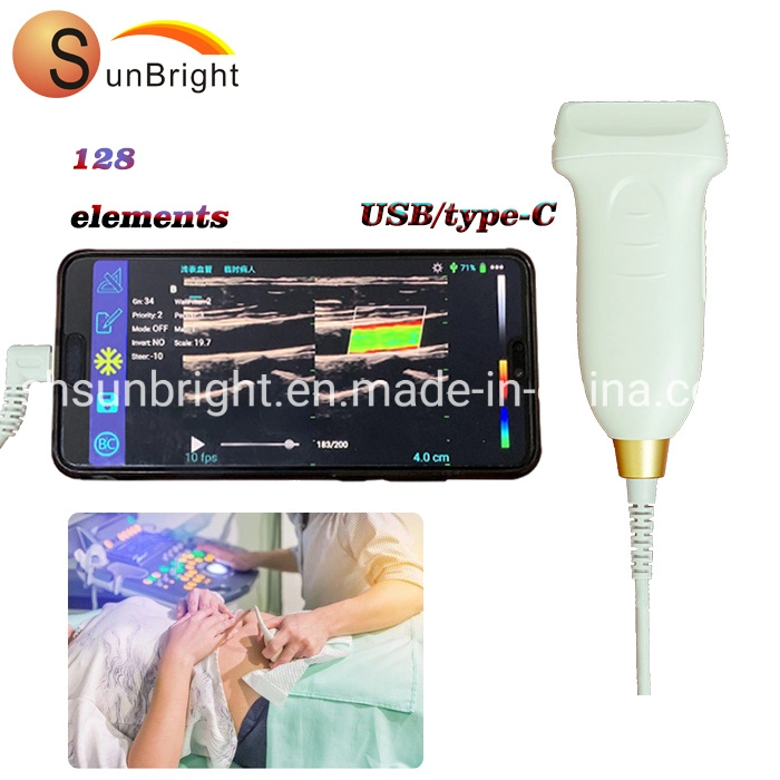 Digital USB Vet médico ultra-sonografia 2D dispositivos de digitalização
