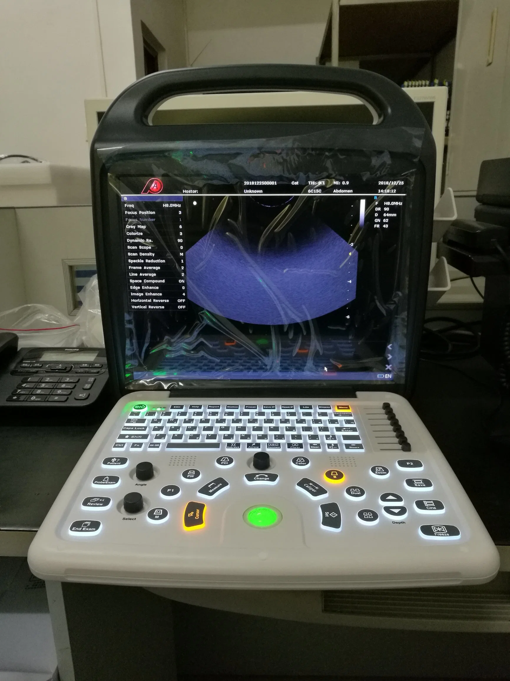 Медицинское оборудование Передвижные медицинские приборы цветной ультразвуковой допплеровский ультразвуковой сканер
