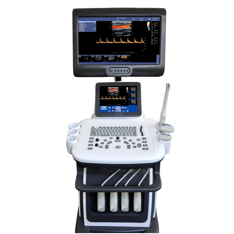 Color Doppler Trolley Ultrasound Machine Price