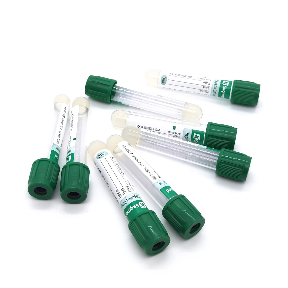 Plasma Tube Green Cap Lithium Heparin Separates Gel Vakuum Blut Auffangrohr