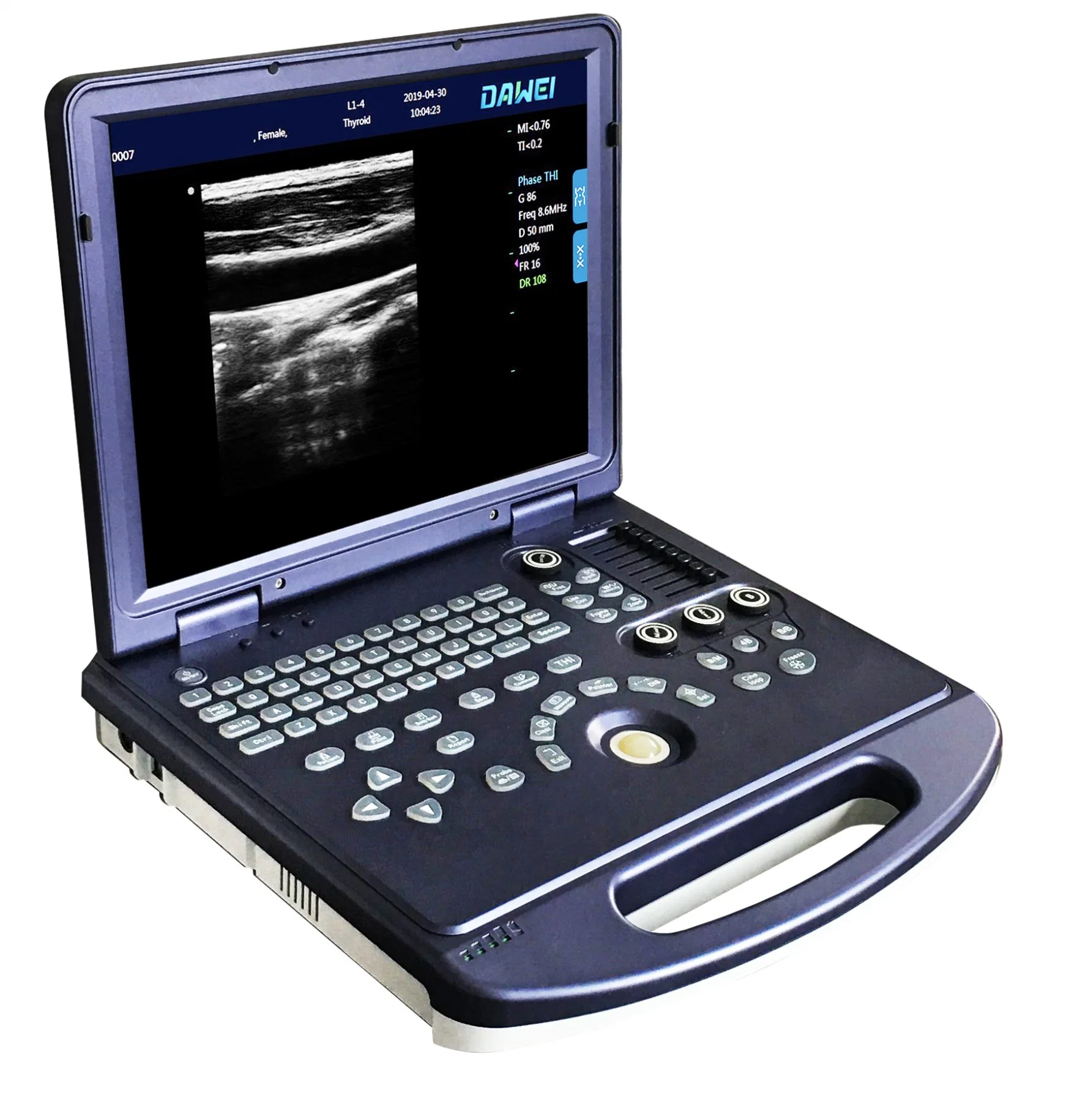 Dw-360 2D Pw Portable B&W Ultrasound Machine From Quality Factory