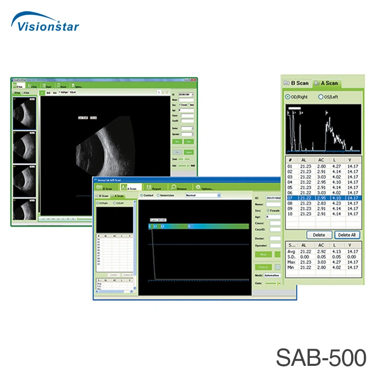 Original Factory Supplier Ophthalmic Equipment Ab Ophthalmic Scan