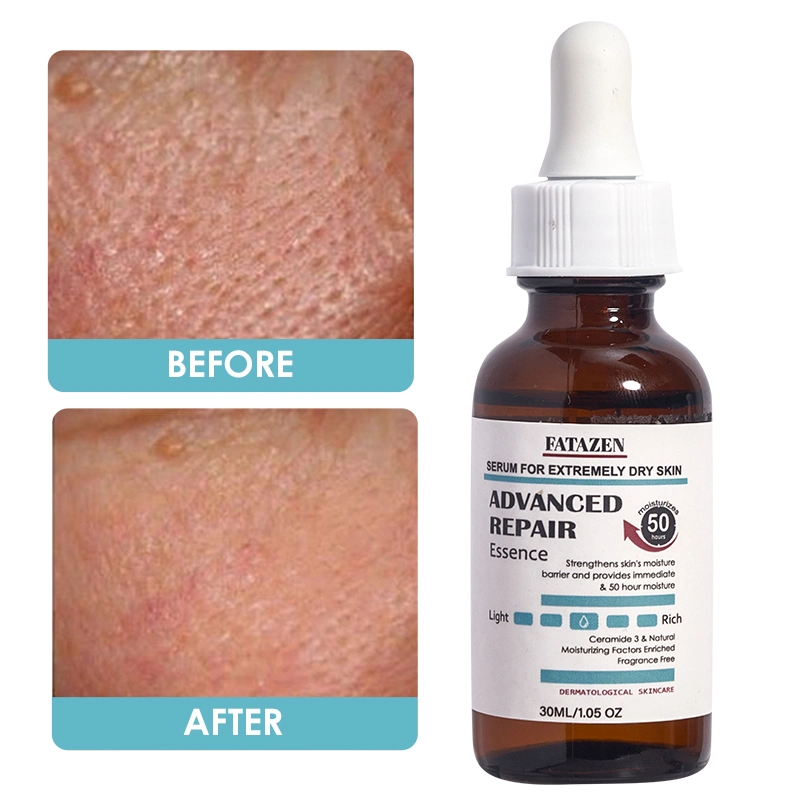 Vitamin B Niacinamide Face Serum Repairing Hydrating Anti-Aging Facial Serum