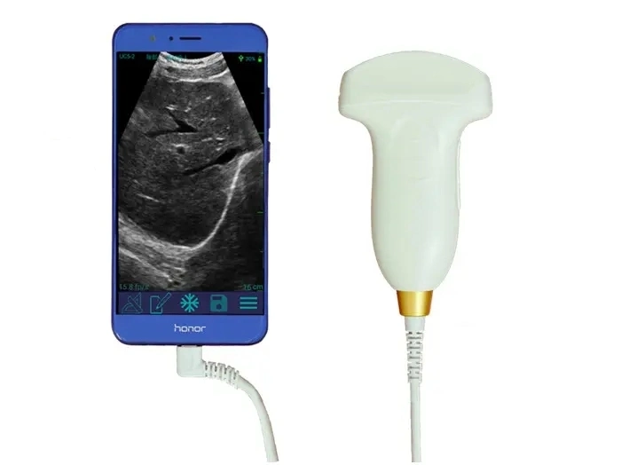 Sonda convexa de máquina de ultrasonidos inalámbrica portátil de 80/128 elementos (THR-USP1)