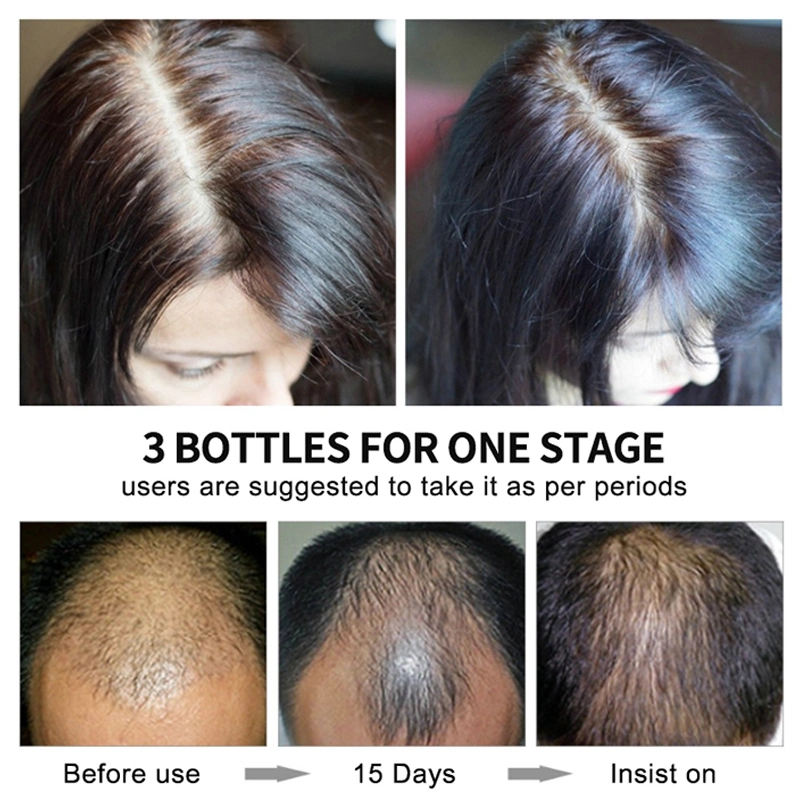 Wholesale/Supplier Ekber Popular Tea Tree Biotin Hair Growth Serum 30ml Conservation Hair Follicle Hair Care Products