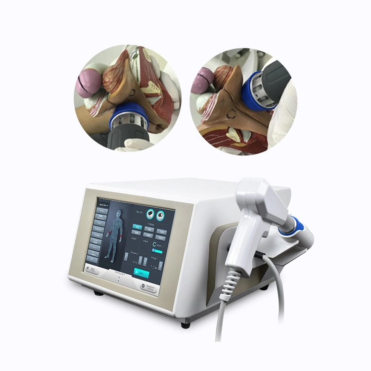 Eswt Radial Erectile Dysfunction Shockwave Therapy Physiotherphy Device