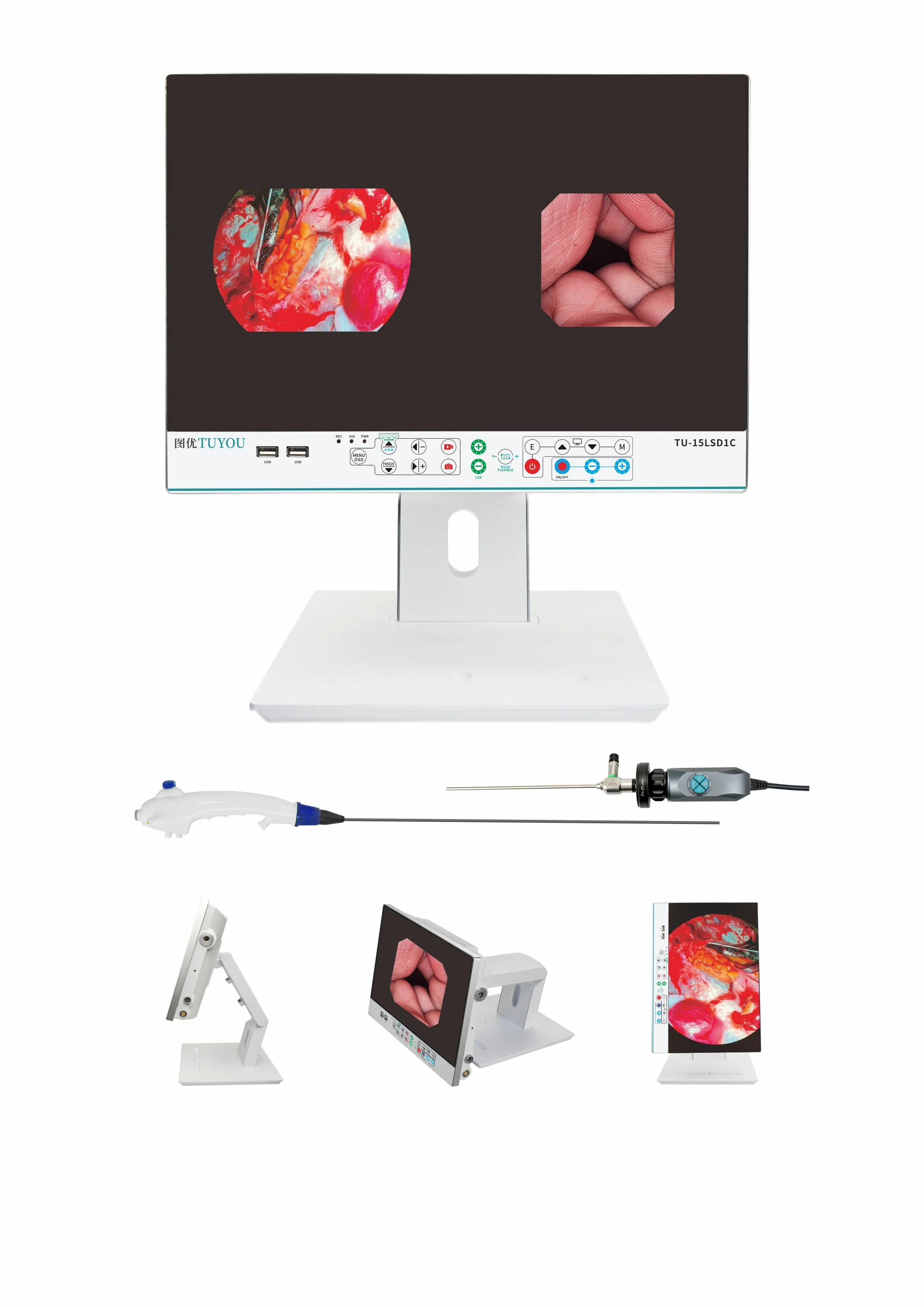 Tuyou Fuente de luz LED Monitor médico endoscopio portátil Cámara CMOS de la Unidad de Endoscopia