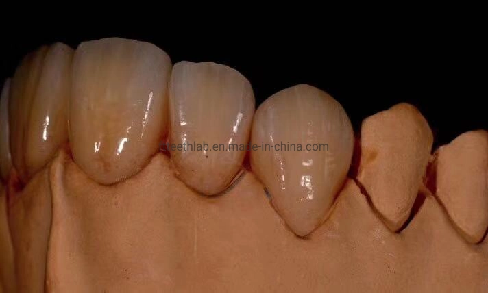 Full Contour Zirconium Bridge Made in China Dental Lab