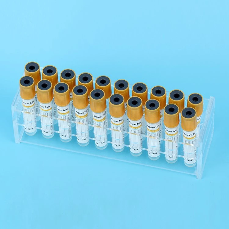 Cheap Disposable 2ml 3ml 4ml 5ml 10ml Non- Vacuum EDTA K2 K3 Pet Glass Blood Test Collection Tubes with China