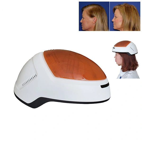 Portable Laser Hair Growth Helmet Low Level Laser Lllt Therapy