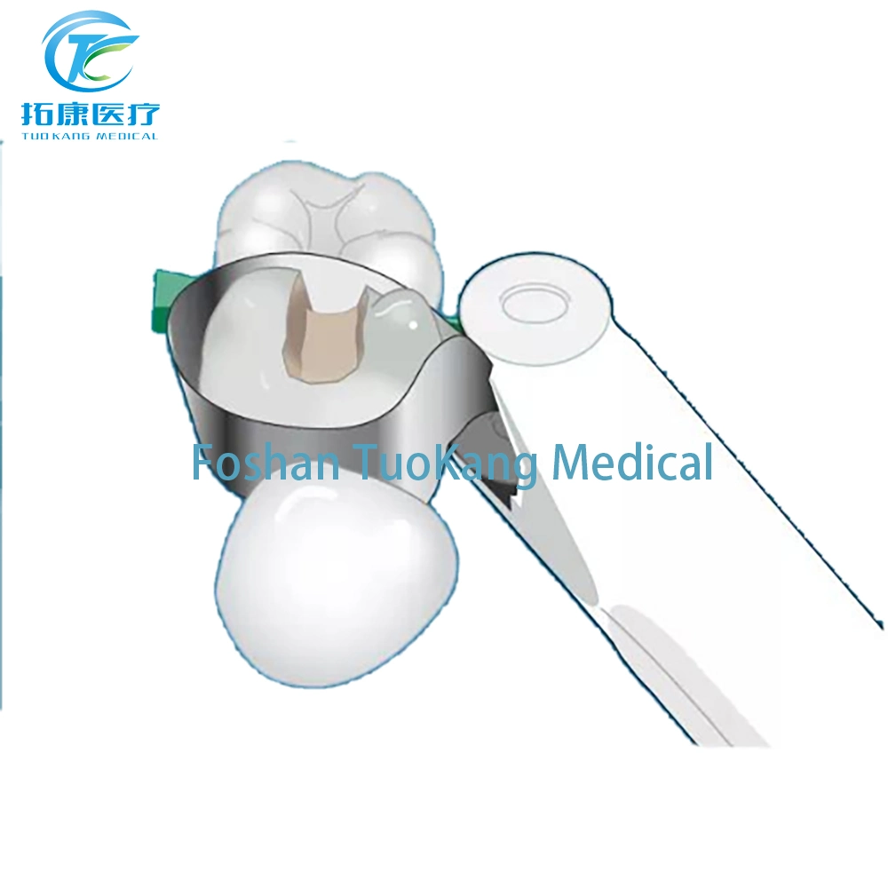 Produto quente Bandas de matriz Dentária Sistema transversal banda matriz matrizes com contornos contornada com preço baixo