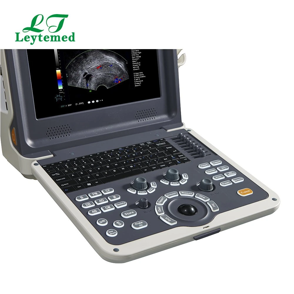 Ltub01V Vet Portable Color Ultrasound Scanner for Hospital