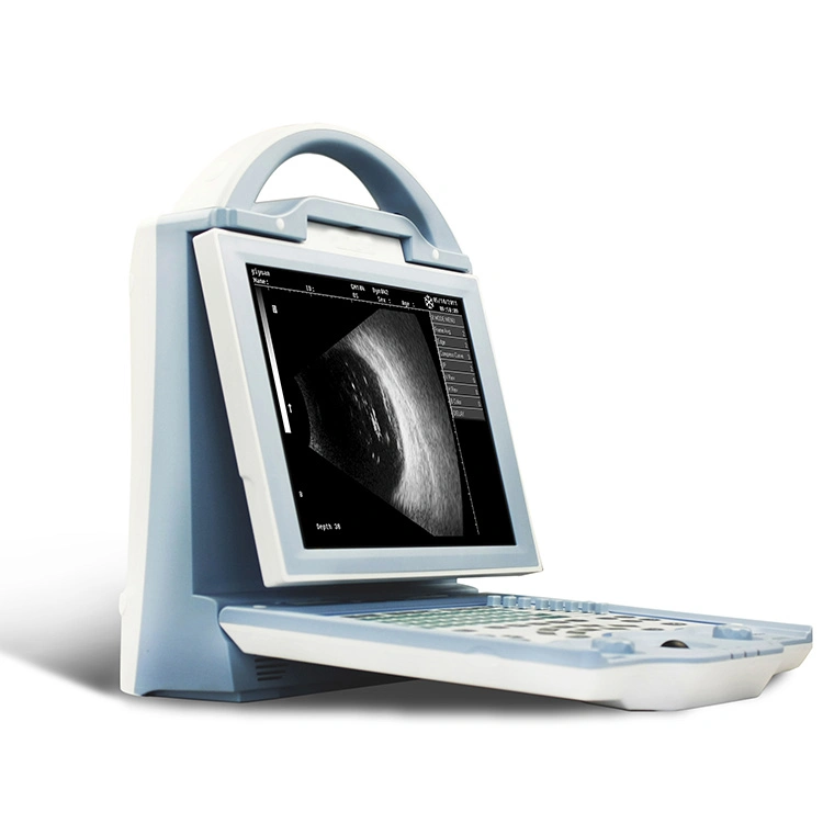 ODU-5 China Factory LED Screen Ophthalmic Ultrasound Scanner Ab Scan