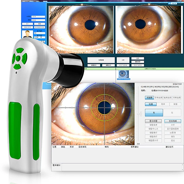 12MP USB Digital Iriscope iridología Analizador de la salud de cuerpo completo