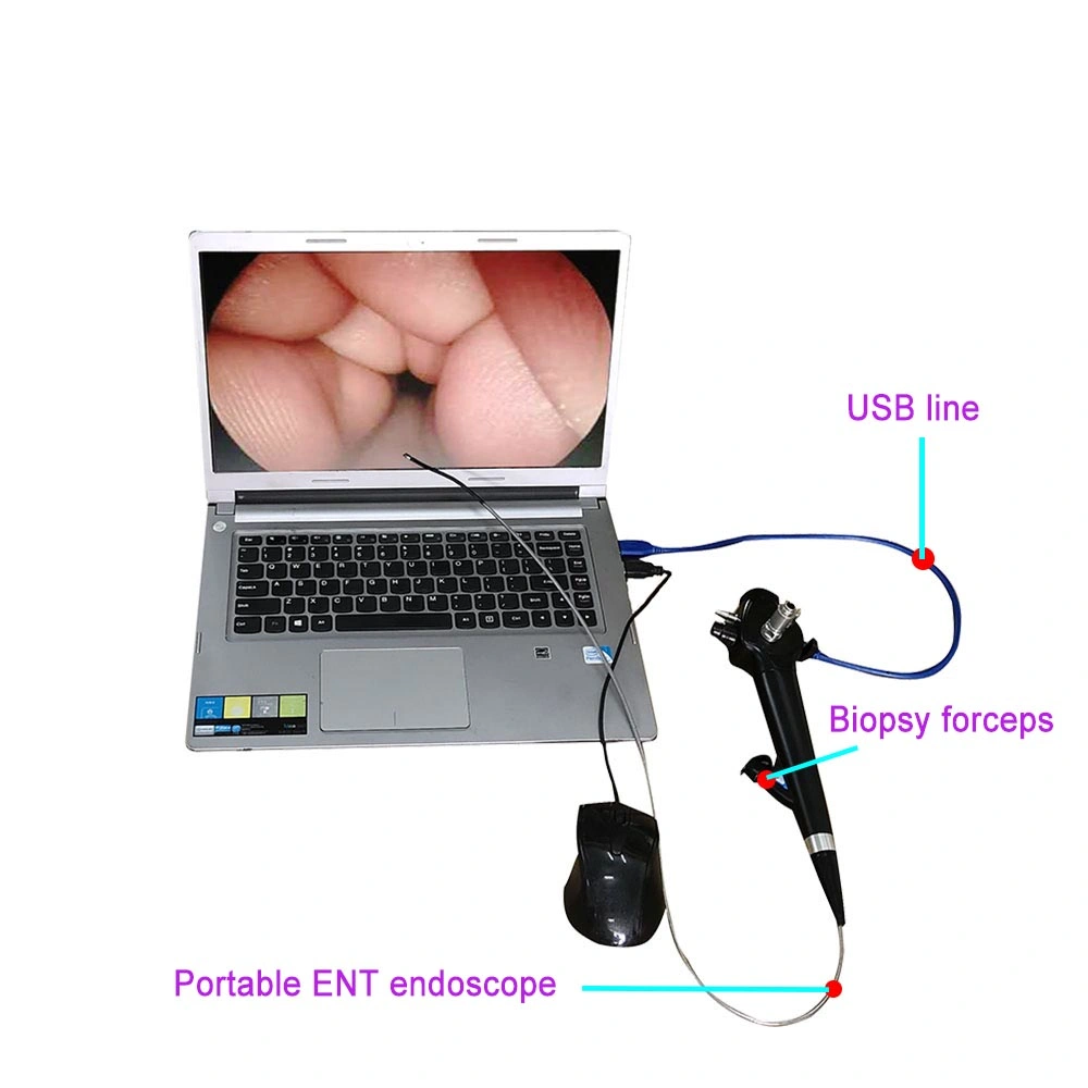 Endoscópio flexível Ent para broncoscópio USB portátil LT-29 Medical