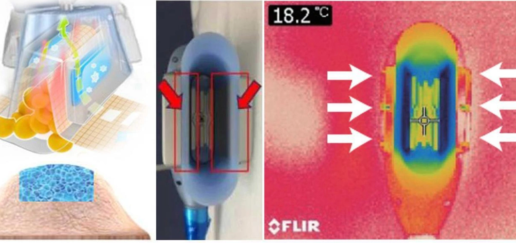 Hot la vente de la Cellulite Cryolipolyse Criolipolisi dépose des plaques