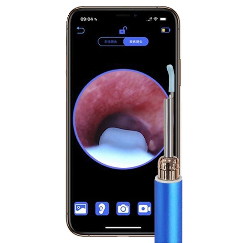 OEM/ODM Ear Cleaning Smart Earpick HD Ear Wax Removal Tool Con LA APLICACIÓN