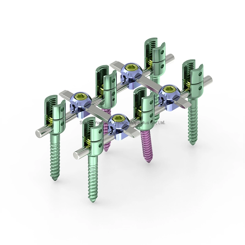 Hintere Thoracolumbar Spinale Fixierung System Titan Wirbelsäule Pedicle Schrauben, Orthopädische Implantate, Orthopädische Instrumente, Medizinische Geräte