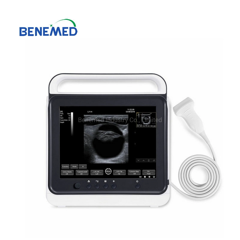 Bm-50A Portable USB Vet Digital Palmtop Pregnant Ultrasound Scanner