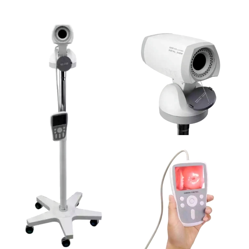 Appareil médical appareil photo numérique portable de colposcope vidéo pour la gynécologie