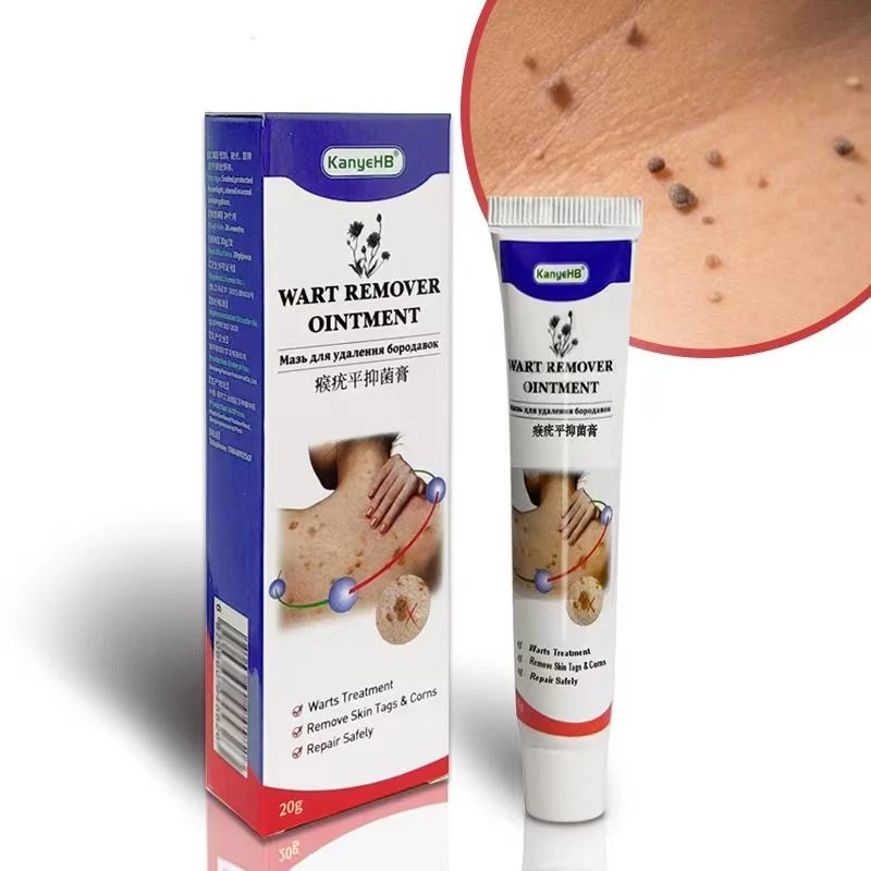 Amazon Hot Vender Nueva llegada Extracto Natural de Herbal Plaster Wart Removedor Crema 20g Corn Wart piel etiqueta de removedor Ointment