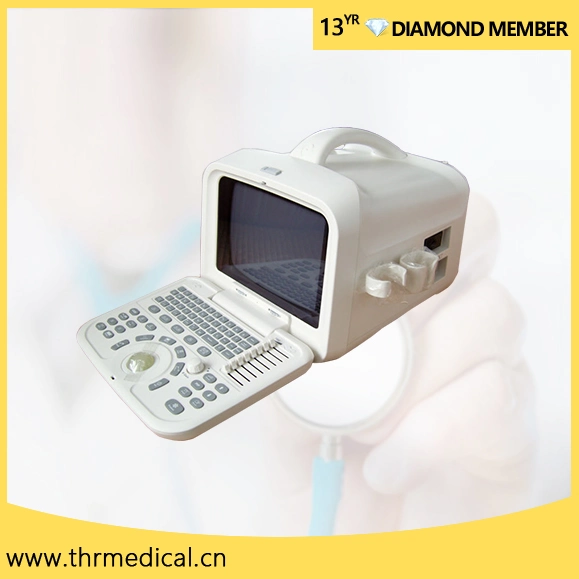 Hospital Medical Portable Ultrasound Scanner Equipment (THR-US6601)