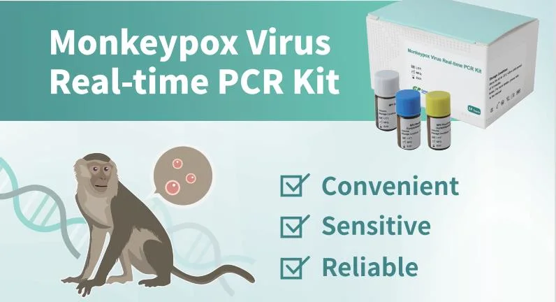 El ácido nucleico del virus Monkeypox Kit de detección de fluorescencia (PCR)