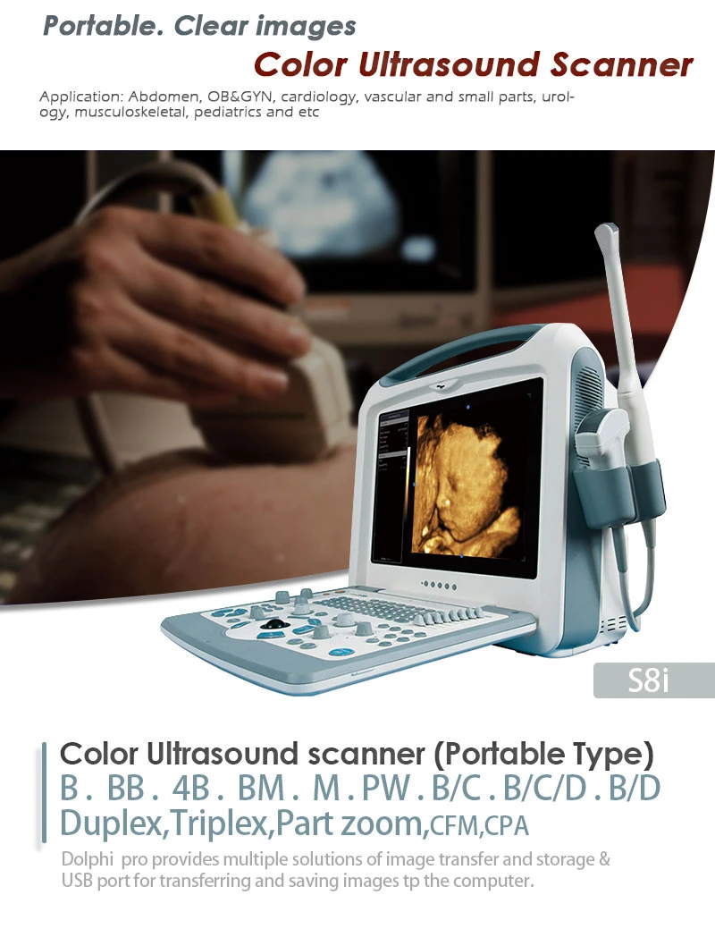 Amazing Color Portable Ultrasound Scanner with Multi Frequency Convex Probe Standard