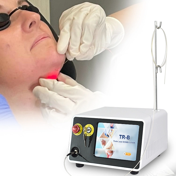 Medizinische 1470nm 980nm Diode Laser Lipolyse Fettentfernung Laser Ablation Therapie