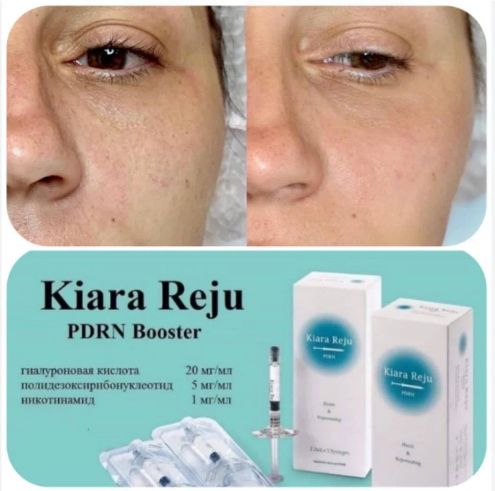 2023 New Kiara Reju 2.2ml*3syringes Hyaluronic Acid+Pdrn Skin Booster for Facial Skin Collagen Regeneration Kiara Reju Elastic Hyaron Bijunel