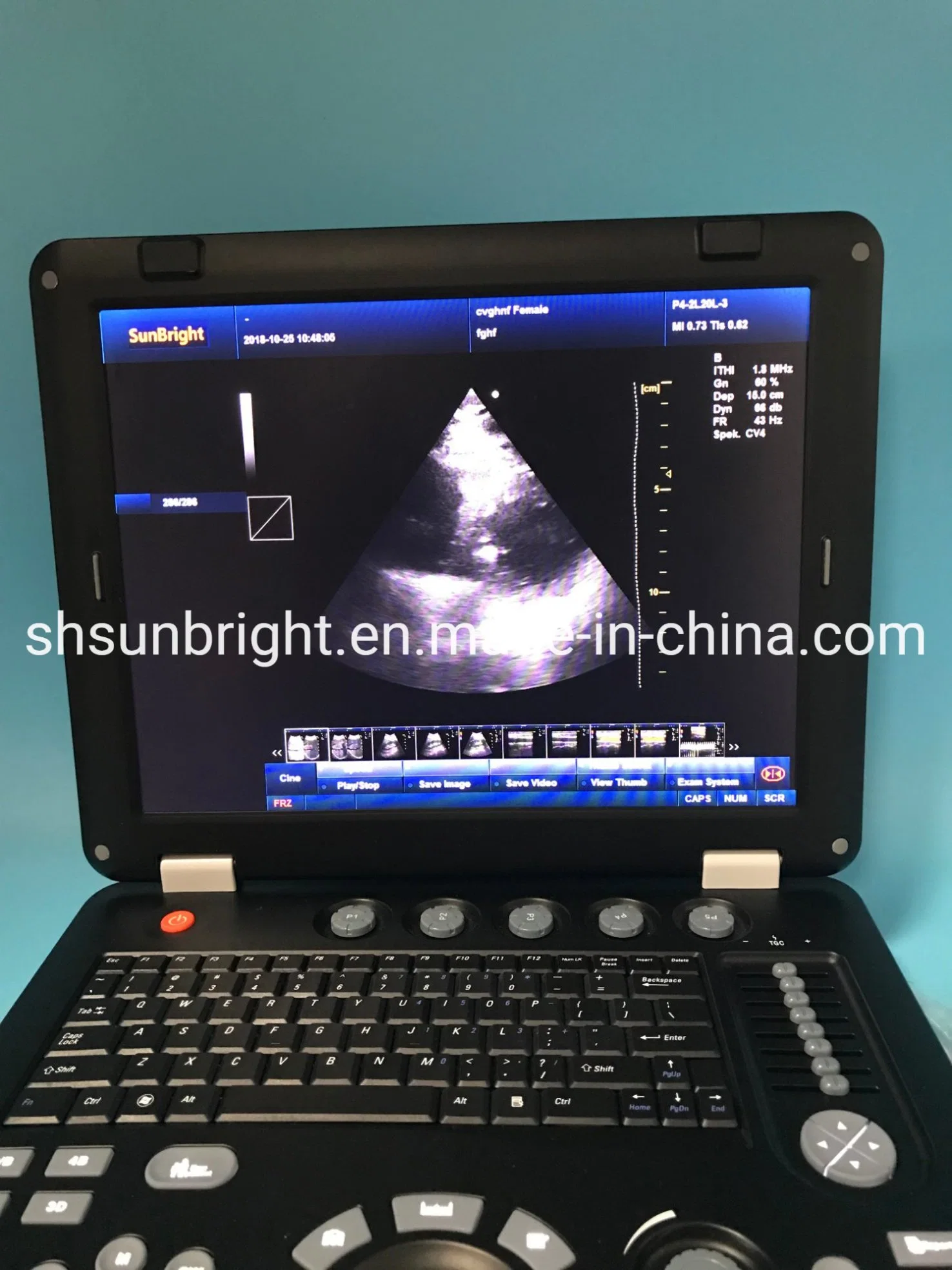 Sun-906A Doppler Ultrasound Laptop 3D 4D Color Doppler Ultrasound