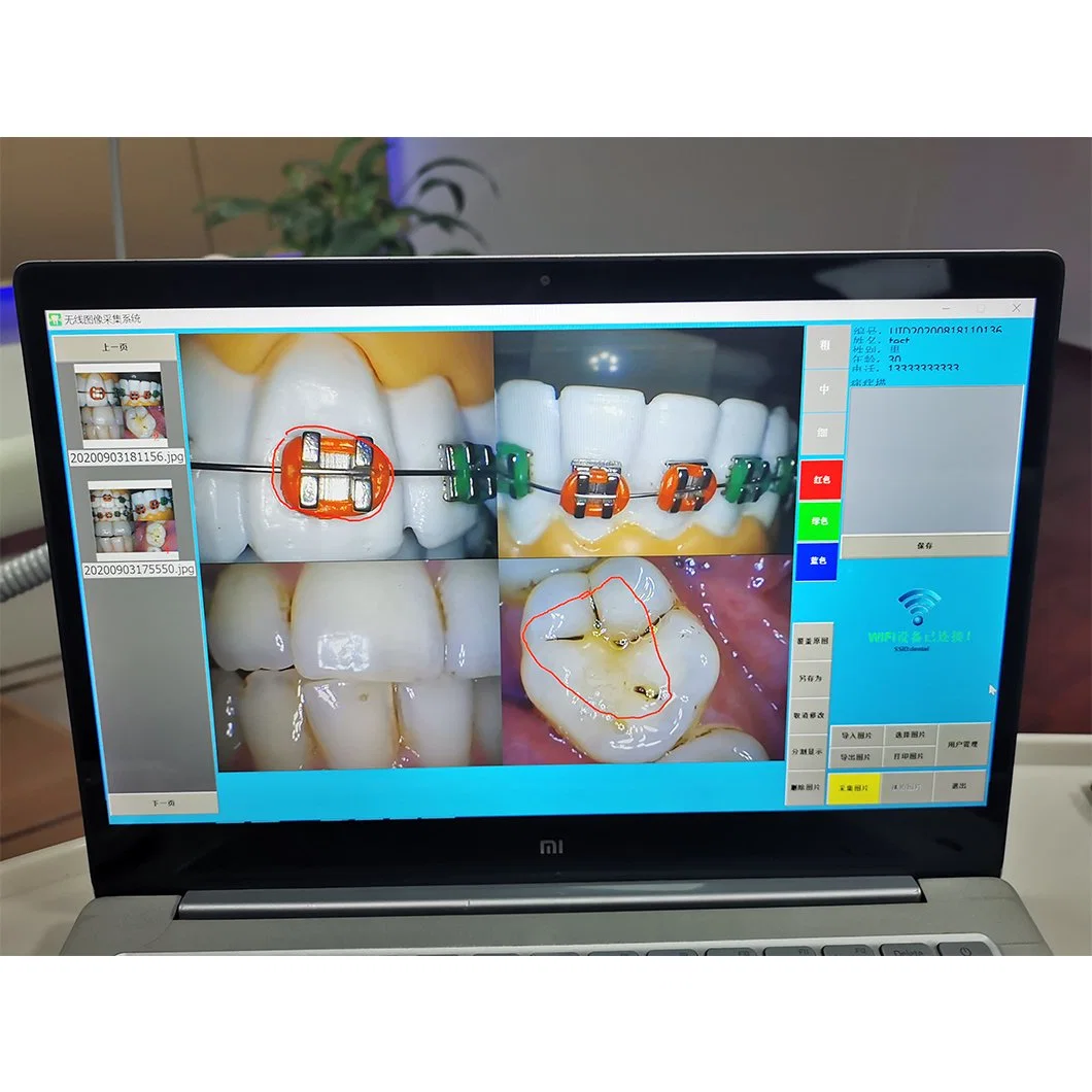 China Supplier Multimedia Monitor Intraoral Camera System