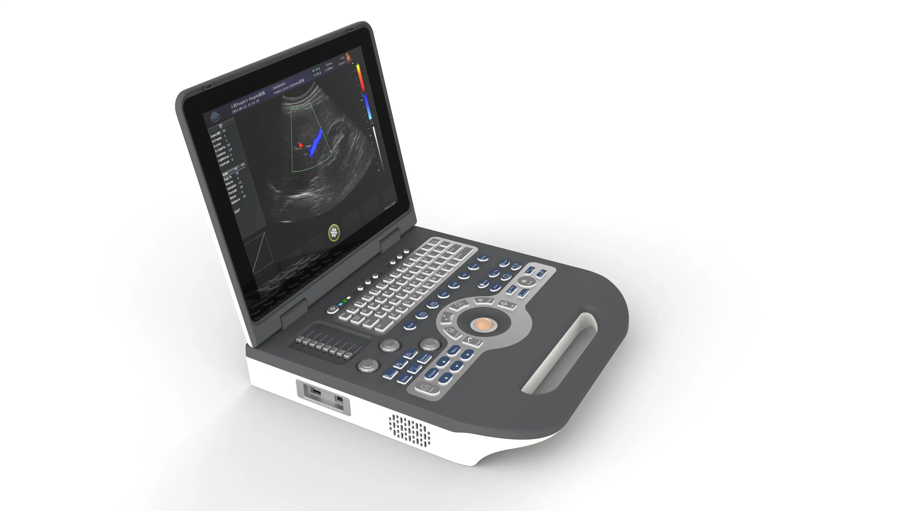 PT-S3500 Portable Color Doppler Ultrasound Machine, Ultrasound Scanner with High Quality