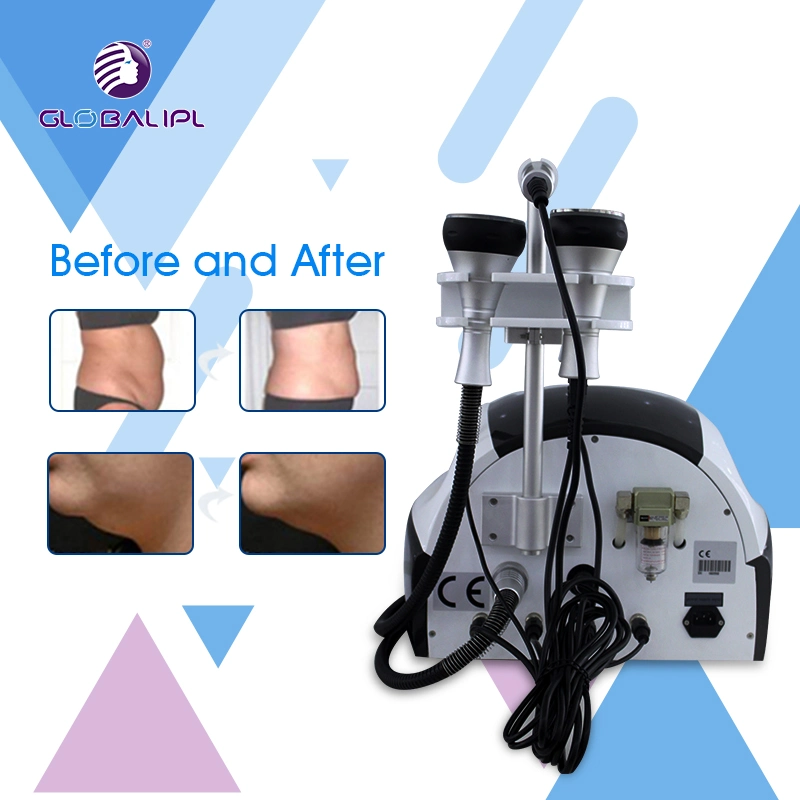 Fast Cavitation Cellulite Reduction Beauty Equipment (US307)