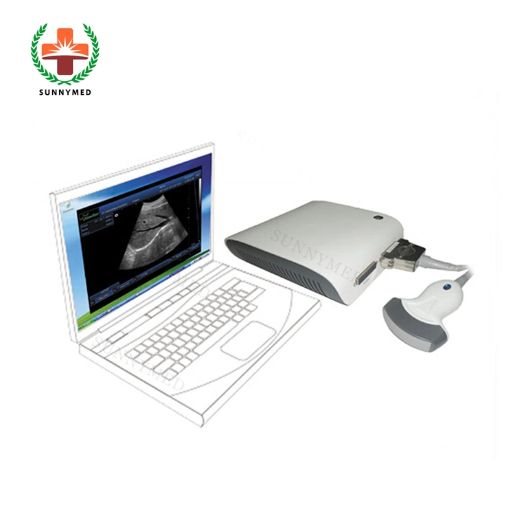 Sy-A010 Windows System Ultrasound Box Ultrasonic Medical Equipment