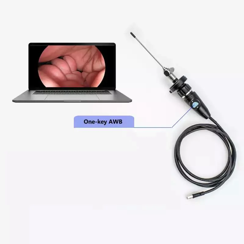 Full HD Endoscope caméra USB portable ent Meidical Ensemble diagnostic