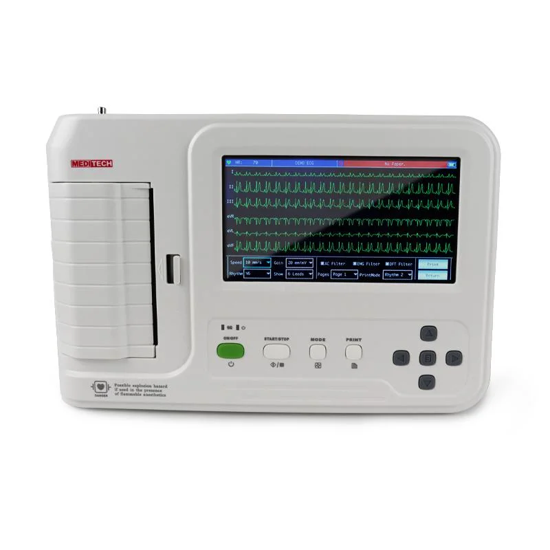 High-End 6-Channel ECG Electrodes ECG/EKG Machine Large Capacity Cardiac Medical Equipment