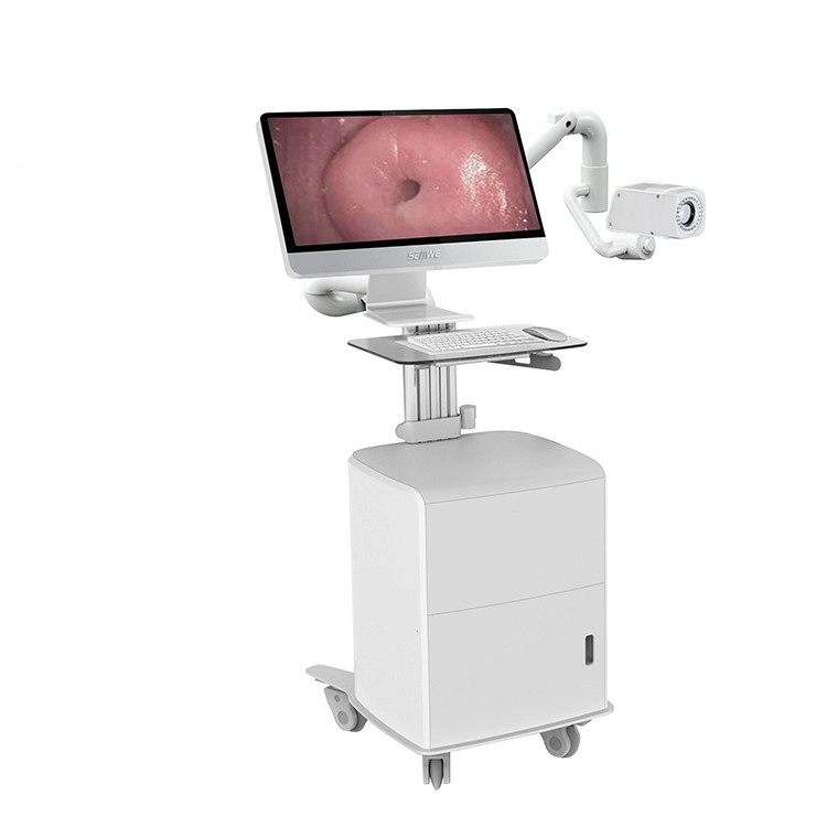 24 بوصة HD Digital Electronic Colposcope سوني -2، 380، 000 بكسل الفيديو Colposcopio الكاميرا