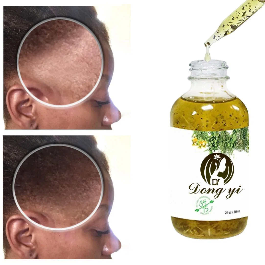 Best Private Label Scalp Treatment Herbal Natural Organic Tea Tree Oil Shampoo with Liquid Keratin Moisturizing Shampoo OEM