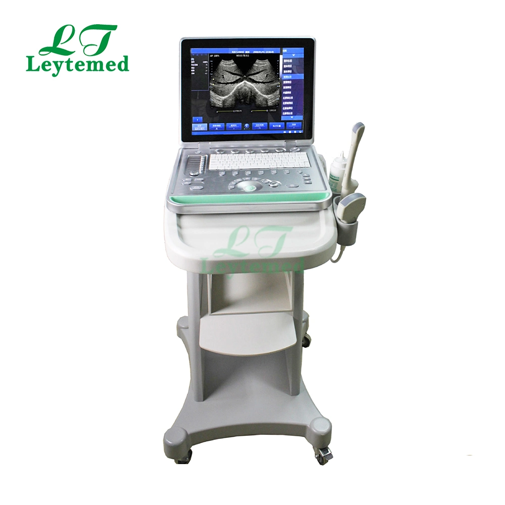 Ltub19 Cheap Portable 15 Inch Laptop Ultrasound Scanner Medical Used for Human