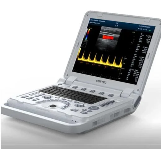 Cms1700b Portable Color Doppler Machine Hospital Ultrasound Scanner