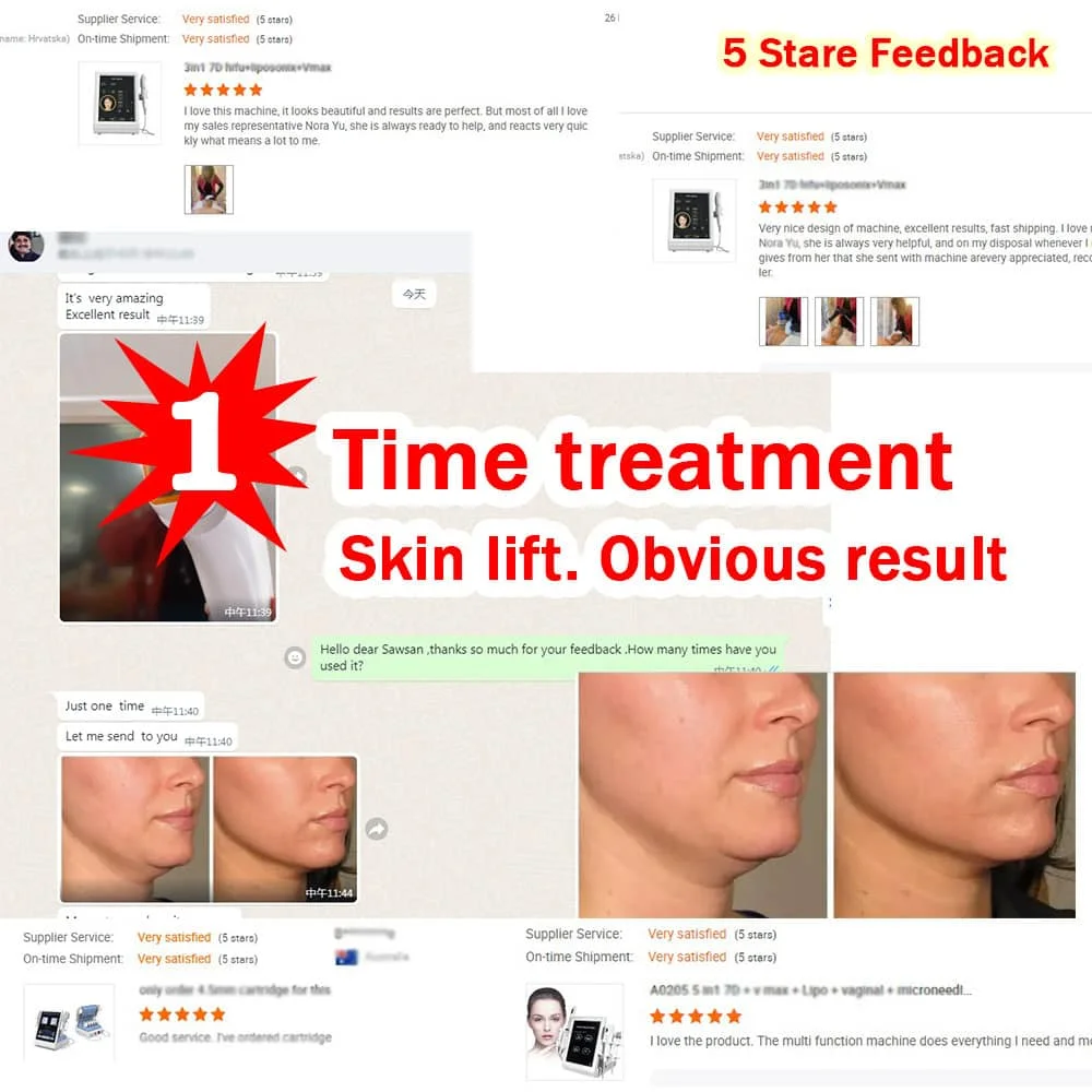 Beauty Machine Face Lifting Intensity Focused Ultrasound Anti Wrinkle Skin Tightening 7D Hifu Vaginal RF Vmax Liposonic