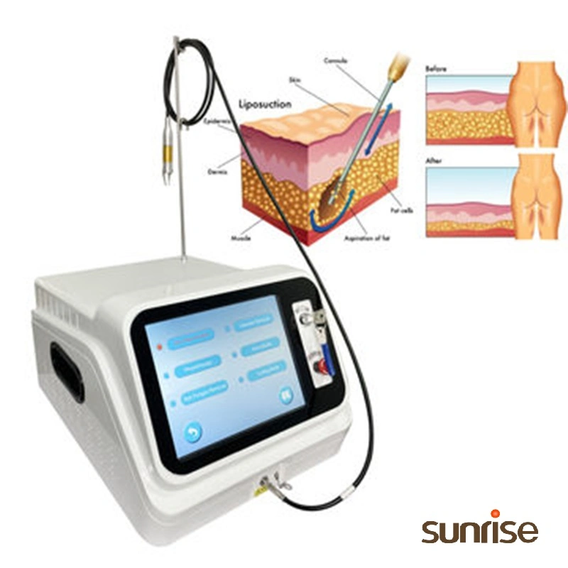 Système de machine laser vasculaire Endolift 980nm laser 1470nm à diode à fibre optique Fabricant d'ablation endoveineuse