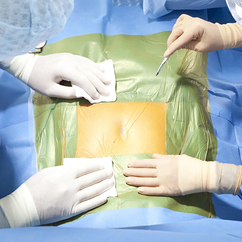 Surgical Incise Film with Iodine