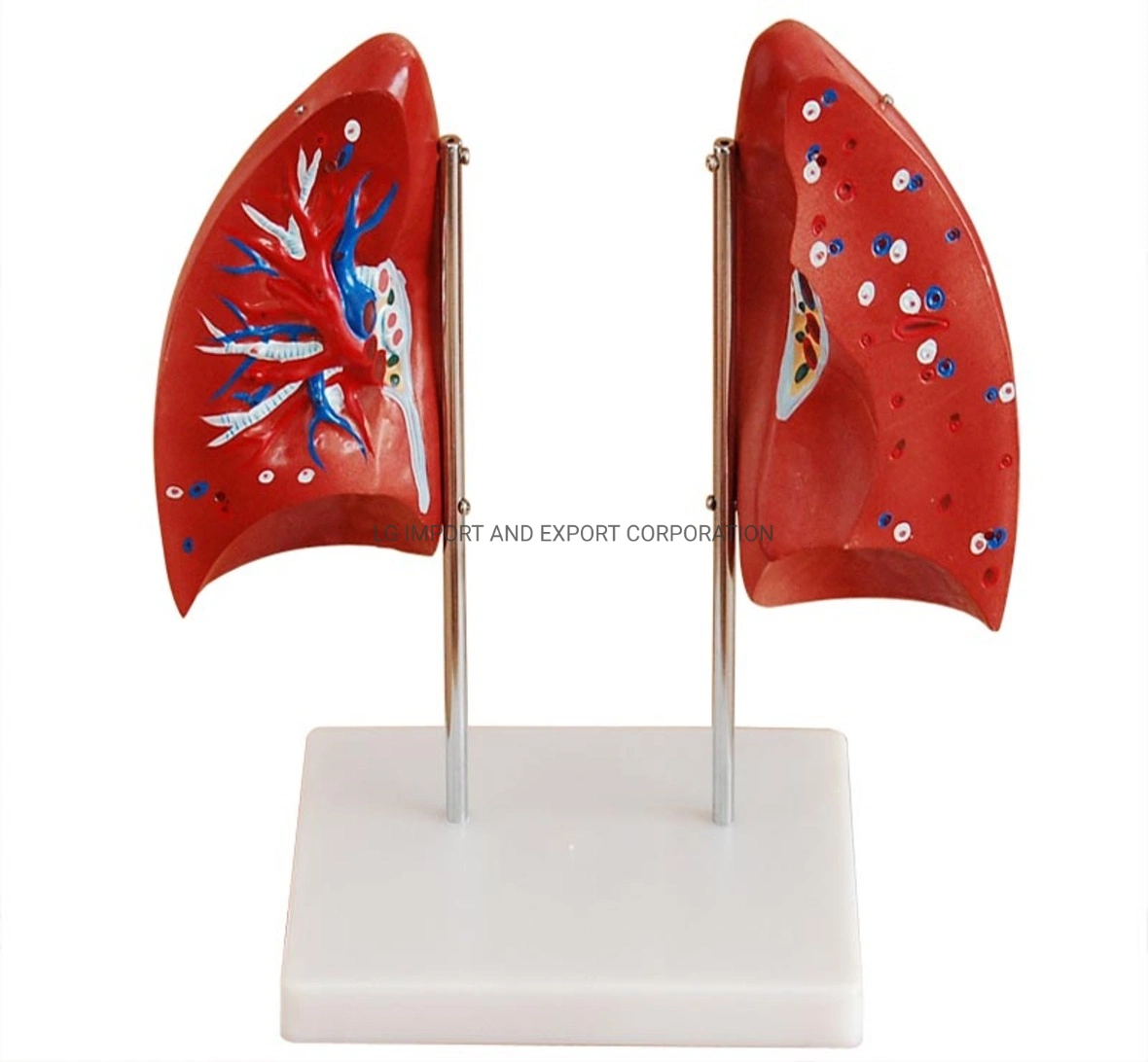 Lung Model for Medical Use