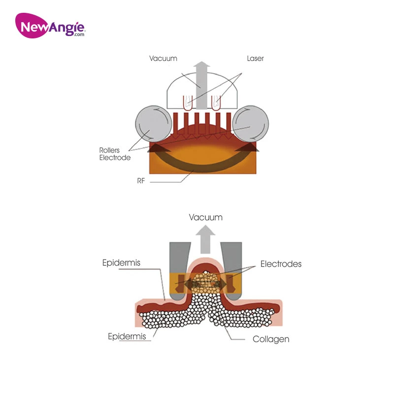 La CE aprobó la aguja de la piel de RF profesional rodillo vacío 4 en 1 de la máquina de belleza