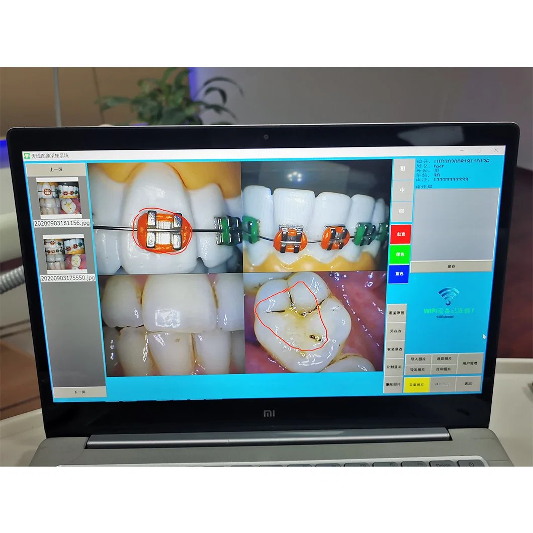 Appareil photo intra-buccal tout-en-un avec système d'endoscope dentaire WiFi de surveillance en option