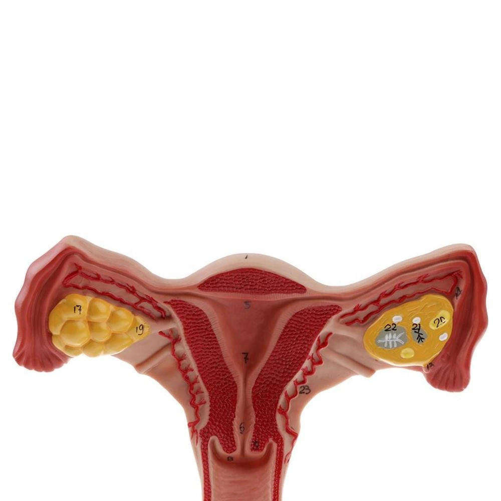 La Anatomía Humana en 3D útero ovario modelo para la biología